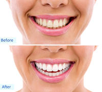 Dentifrice dentaire professionnel de blanchiment des dents de marque privée dentifrice au charbon de bambou