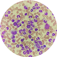 Fixed set Blood Test for medical microscope slide blood smear prepared microscope slides