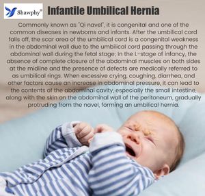 Cinturón de <span class=keywords><strong>Hernia</strong></span> Inguinal Umbilical para Bebés Recién Nacidos, Soporte para el Ombligo, Tratamiento con Adhesivos, Protección Abdominal Infantil, Botón, 3 Almohadillas de <span class=keywords><strong>Hernia</strong></span> de Algodón - Product Image 5
