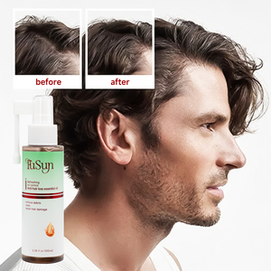 תרסיס נגד נשירת שיער פאנסון, פורמולה 2 ב-1 לצמיחת שיער, חידוש זקיקי השיער, בקרת שומן, נגד קשקשים, תמצית ג'ינג'ר - Product Image 4