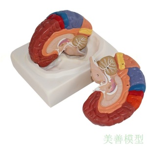 Modèle de crâne coloré détachable et grand format, authentique, représentant l'anatomie du cerveau humain et les ventouses. - Product Image 4