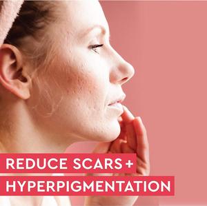 <span class=keywords><strong>Huile</strong></span> <span class=keywords><strong>essentielle</strong></span> de rose musquée biologique de marque privée JY pour anti-rides, éclaircir la peau, réduire les cicatrices d'acné et lisser pour le <span class=keywords><strong>visage</strong></span> et les cheveux - Product Image 3