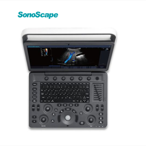 Ecógrafo Doppler Color Portátil Sonoscape E1EXP, Mejor <span class=keywords><strong>Precio</strong></span>, Escáner de Ultrasonido E1 Expert para Obstetricia y Ginecología - Product Image 1