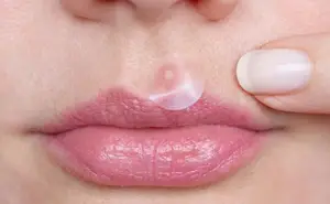 韓国の化粧品アクネピンプルパッチOEM医療用ハイドロコロイドピンプルアクネハートパッチ