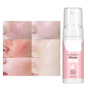 Fabricante OEM ODM 4 en 1 limpieza profunda hidratante espuma lavado de cara <span class=keywords><strong>limpiador</strong></span> <span class=keywords><strong>facial</strong></span> para pieles sensibles - Product Image 2