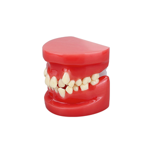 Modelo de Maloclusión Dental para Prácticas de Estudiantes de Odontología, Enseñanza, Entrenamiento, Comunicación, Equipo Médico Bucal - Product Image 4