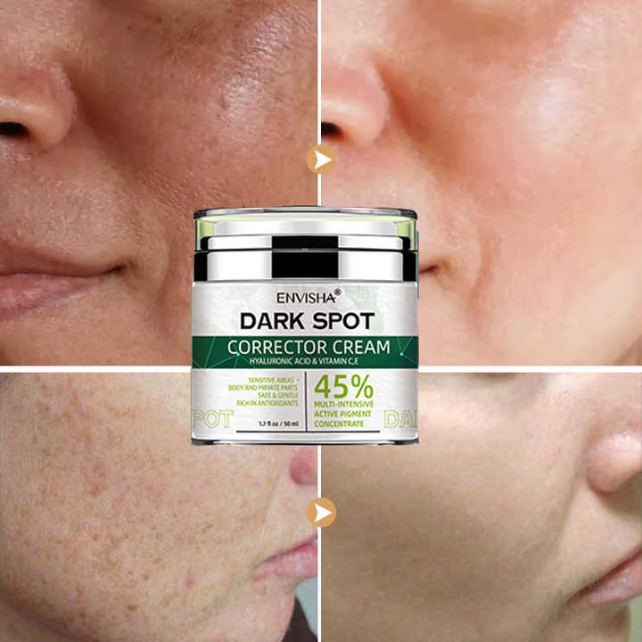 Free Sample Dark Spot Corrector Brightening Blemish Remover Natural Korea Skin Care Face Whitening Freckle Cream