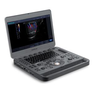 Sonosbape X3 X5 mesin <span class=keywords><strong>Ultrasound</strong></span>, sonosap dokter hewan atau versi manusia <span class=keywords><strong>Ultrasound</strong></span> - Product Image 1