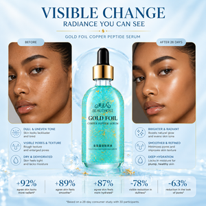 Venta al por mayor coreana Etiqueta Privada 24K oro suero Facial reparación tratamiento del acné calmante cuidado de la piel sensible suero de esencia Facial - Product Image 3