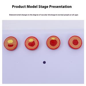 Yaşlılar İçin Deren DR Koronari Arter Kardiyovasküler Modeli Tromboz Kalp Hemşiresi Eğitimi Tıp Bilimi Sertleştirme - Product Image 3