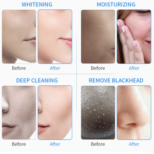 Mặt làm sạch tần số cao mặt hydradermabrasion máy da thắt chặt làm trắng oxy nước máy bay phản lực máy trên khuôn mặt - Product Image 4
