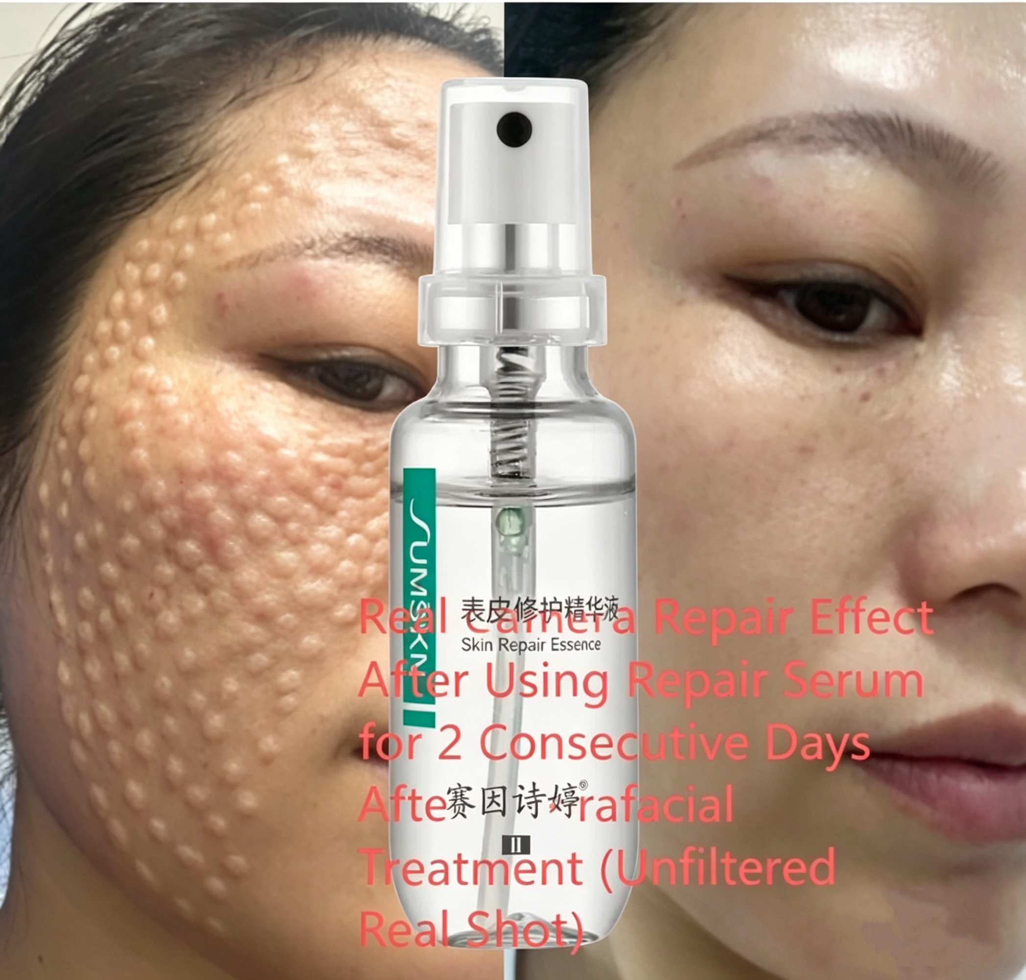 SUMSKM Skin Repair Essence 30ml, Oligopeptide-1 & Niacinamide Serum, Soothing & Hydrating, in Stock OEM/ODM