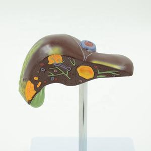 Патологическая модель печени человека, рак печени для школы, медицинский обучающий дисплей, лабораторное оборудование - Product Image 6