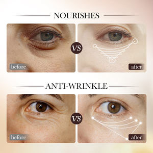 Sérum pour les yeux OEM SADOER, marque privée, rétinol, niacinamide, éclaircissant, raffermissant, anti-âge, soin des yeux, utilisation quotidienne - Product Image 6