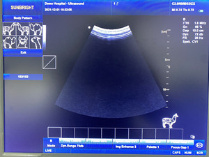 Sistem Ultrasound Veteriner B/W Berkualitas Tinggi dan Murah, Perangkat Ultrasound <span class=keywords><strong>Doppler</strong></span> - Product Image 6