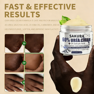 Crème à <span class=keywords><strong>l</strong></span>'<span class=keywords><strong>urée</strong></span> 60% + Acide salicylique 2% Crème pour les pieds Convient pour réparer les talons gercés, les cuticules et les peaux mortes - Product Image 1