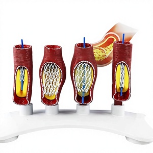 Modelo Anatómico de <span class=keywords><strong>Stent</strong></span> Vascular Humano Huichun SMM3192 (PVC) para Educación en Ciencias Médicas - Arteria Coronaria - Product Image 2