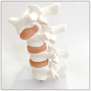 Modelo de osteoporosis de hueso humano Anatomía lumbar patológica Modelo de enseñanza de sección transversal espinal - Product Image 2
