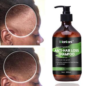 Mankani 300ml Botol Perawatan Rambut <span class=keywords><strong>Herbal</strong></span> Organik Sehat, Sampo dan Kondisioner Pengontrol Minyak, Perawatan Rambut Rontok dengan Jahe yang Menebalkan - Product Image 2