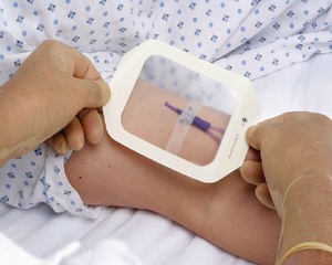ציוד רפואי חד פעמי דבק סטרילי לנשימה תחבושת Mediq IV שקופה - Product Image 4