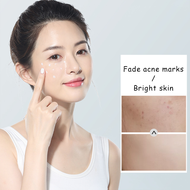 Бесплатный образец крема для удаления веснушек быстро портативный крем для удаления веснушек против веснушек оптовая продажа