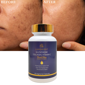 Private Label Organic Collagen Health Supplement Skin Whitening Remove Dark Spot Glutathione Brightening <strong>Capsule</strong> - Product Image 2