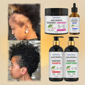 <span class=keywords><strong>Champú</strong></span> y Acondicionador para el Cuidado del Cabello con Romero, para Cabello Largo y Rizado, que Estimula el Crecimiento y Previene la Caída, Suave y Sedoso, Venta al Por Mayor - Product Image 1