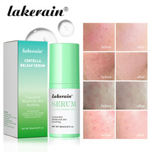 Sérum à la Centella Asiatica, best-seller, nourrissant en profondeur, hydratant longue durée, lissant, apaisant et réparateur - Product Image 5