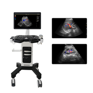 Échographie diagnostique vétérinaire 2B/4B, système d'échographie <span class=keywords><strong>Doppler</strong></span> couleur vétérinaire à ondes pulsées - Product Image 2