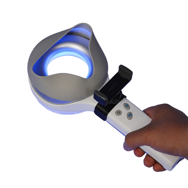 Vitiligo Dermascope VS-9000B Wood's Lamp Analyzer for Skin Vitiligo Psoriasis Rehabilitation Therapy Supplies