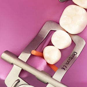 ตัวแยกฟันสแตนเลสสีงาช้าง สำหรับฟันหน้าและฟันหลัง แบบลิ่ม - Product Image 2