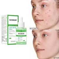 Soin peau douce biologique pour l'acné, produit de soin pour peau sensible, Anti-vieillissement, sérum de traitement pour l'élimination de l'acné