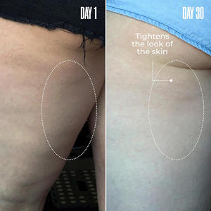 OEM Lift Firm Booty Mask Leave-On Celulitis Mask Reduce la celulitis Visiblemente Apriete Booty Muslos Brazilian Peppertree Mask - Product Image 3