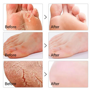 모이카 스킨 내추럴 | 발 마스크 | 알로에 베라 | 40ML - Product Image 2