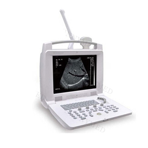 SY-A005 Portable <strong>Cheap</strong> Vet <strong>Ultrasound</strong> Animal <strong>Ultrasound</strong> Scanner <strong>Ultrasound</strong> <strong>Machine</strong> With Internal Printer - Product Image 6