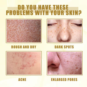 OEM/ODM Peeling Oil Body Skin Legs Face Whitening Bleaching Natural Organic Peel Oil Extra Strong Exfoliating Yellow Liquid - Product Image 3