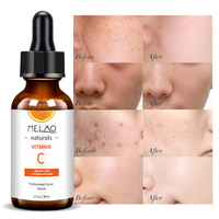 Sérum à la vitamine C de haute qualité, hydratant et éclaircissant, pour les soins de la peau, marque privée