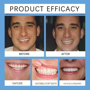 Set di Protesi Dentarie, Kit per Cura Dentale, Faccette Anti-Molare, Ortodontia Cosmetica, Denti a Scatto per Sorriso - Product Image 3