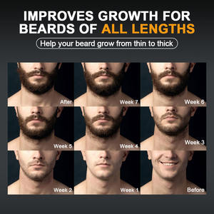 Produits <span class=keywords><strong>de</strong></span> croissance <span class=keywords><strong>de</strong></span> <span class=keywords><strong>la</strong></span> <span class=keywords><strong>barbe</strong></span> pour hommes avec logo personnalisé, sérum <span class=keywords><strong>de</strong></span> repousse rapide <span class=keywords><strong>de</strong></span> <span class=keywords><strong>la</strong></span> <span class=keywords><strong>barbe</strong></span>, huile, kit <span class=keywords><strong>de</strong></span> <span class=keywords><strong>barbe</strong></span> pour hommes, soins <span class=keywords><strong>de</strong></span> toilettage - Product Image 4