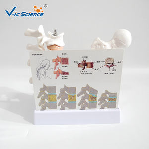 Modèle d'os pathologique en PVC pour l'ostéoporose avec carte dorsale - Modèle de <span class=keywords><strong>squelette</strong></span> <span class=keywords><strong>humain</strong></span> - Product Image 6