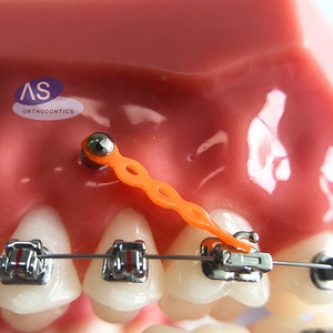 Tandheelkundige orthodontische schroefaccessoires implantaat endossaal - Product Image 6