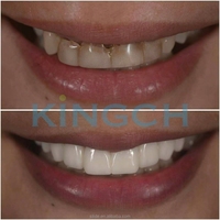 Bloc de zircone dentaire multicouche super translucide 3D Plus, disque de zircone pour la restauration esthétique antérieure des dents
