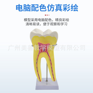 Modelo de dientes incisivos, caninos y molares humanos ampliados 12 veces; herramienta didáctica para el desmontaje anatómico de la pulpa dental y el nervio. - Product Image 5
