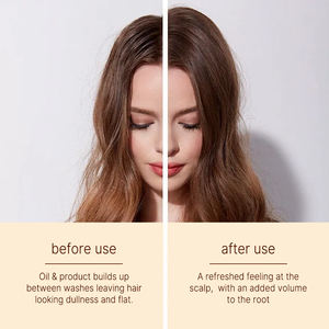 Shampooing <span class=keywords><strong>sec</strong></span> concentré sans rinçage à contrôle d'huile avec votre logo, ODM, volumisant, pour <span class=keywords><strong>cheveux</strong></span> <span class=keywords><strong>gras</strong></span> - Product Image 2