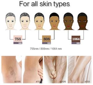 Acebeauty-máquina de depilación láser Weifang Huamei, de titanio, 755nm, 808nm, 1064nm, diodo transparente - Product Image 4