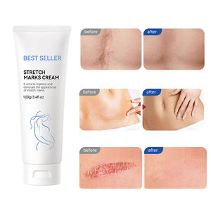 Crème <span class=keywords><strong>Anti</strong></span>-Vergetures Bio Naturelle, Sûre et <span class=keywords><strong>Efficace</strong></span> pour la Réparation Post-Accouchement - Product Image 1