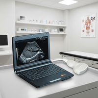 Mesin USG Laptop B Portabel Ringan dengan Baterai SUN-808S