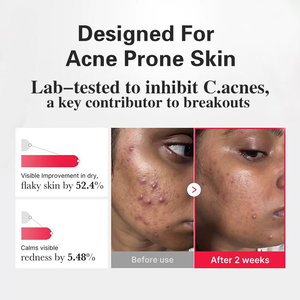 <span class=keywords><strong>S</strong></span> Hypochlorous Acid Peel Shot Glow Ampoule Suero exfoliante de día y noche con extracto de arroz para eliminación de espinillas y refinación de poros - Product Image 5