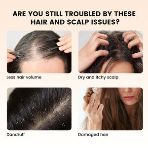 Aceite de Romero de Marca Privada 120ml, Logotipo Personalizado, Orgánico, Sin Crueldad, en Botella de Regalo - Product Image 5