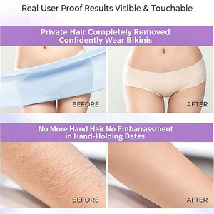 Tondeuse bikini <span class=keywords><strong>pour</strong></span> femmes 3 en 1, <span class=keywords><strong>rasoir</strong></span> électrique, tondeuse <span class=keywords><strong>pour</strong></span> poils du nez, étanche, <span class=keywords><strong>pour</strong></span> poils pubiens, aisselles, jambes, bras, corps - Product Image 6